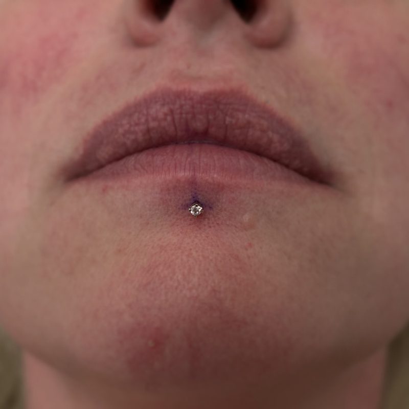 Lip piercing at Apollo — Apollo Tattoo & Piercing Studio 3