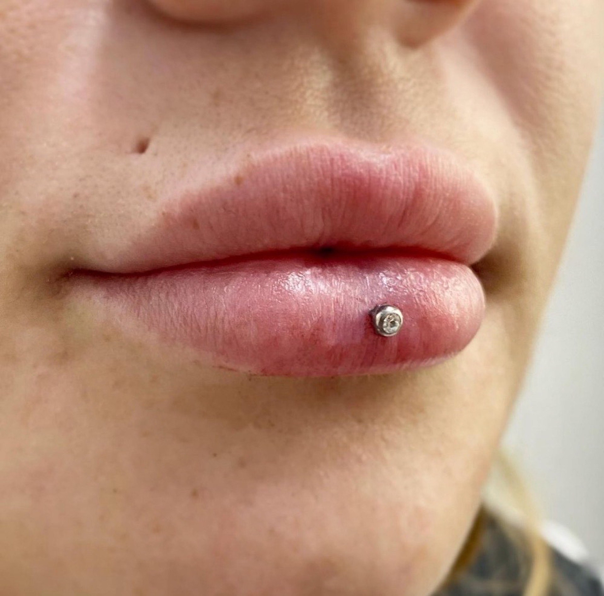 Oral Jewelry Upgrades