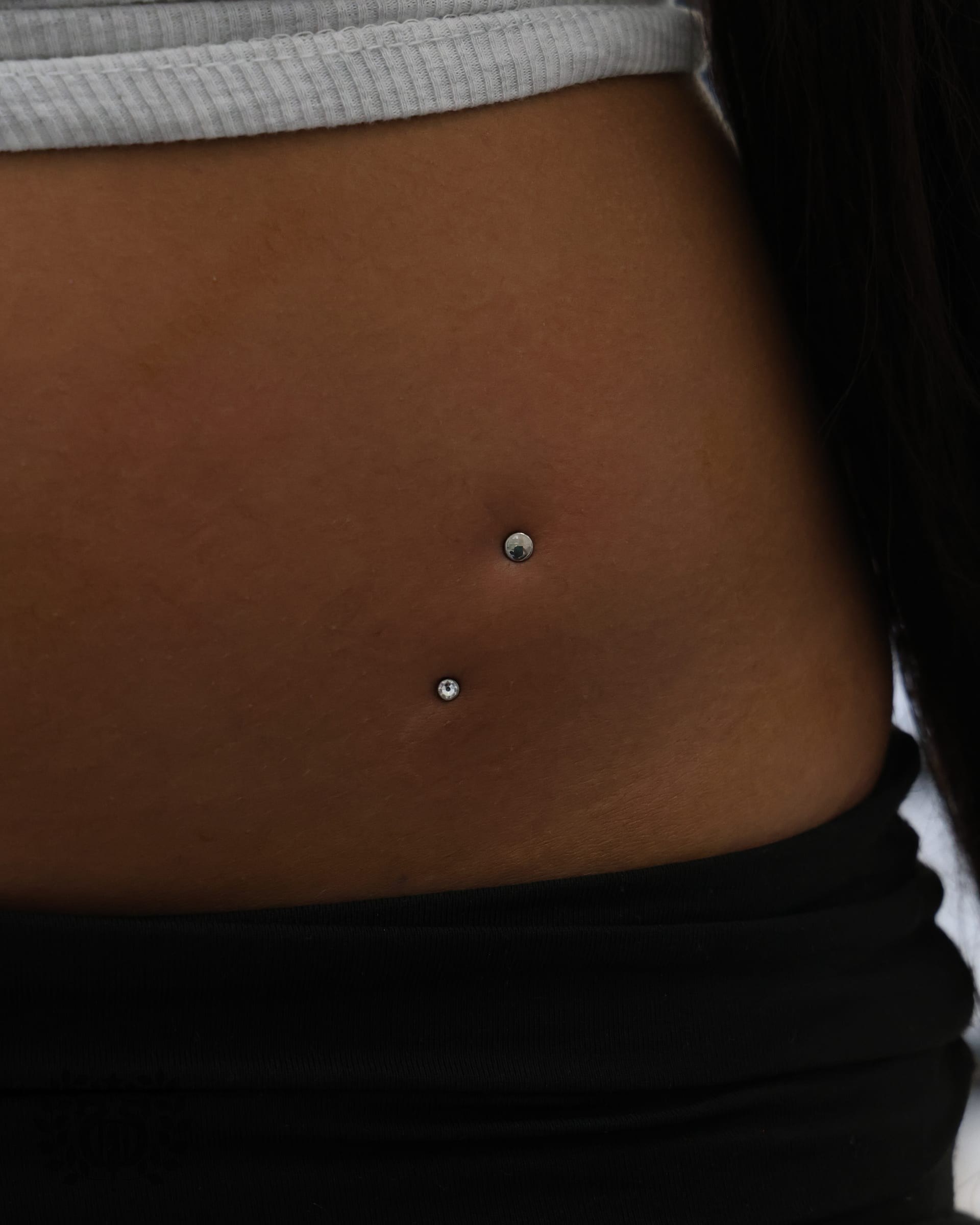 Dermal Anchors