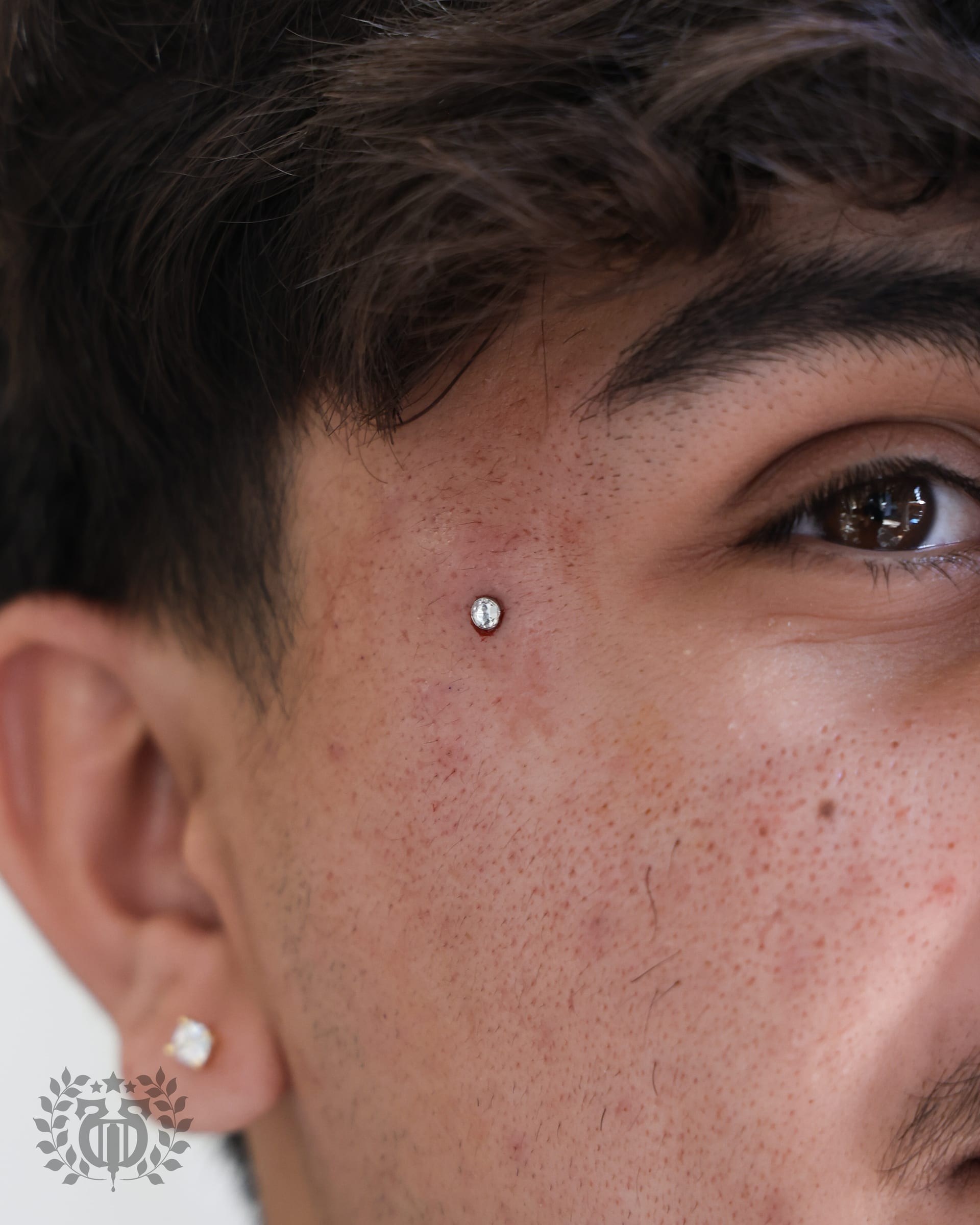 Dermal & Surface