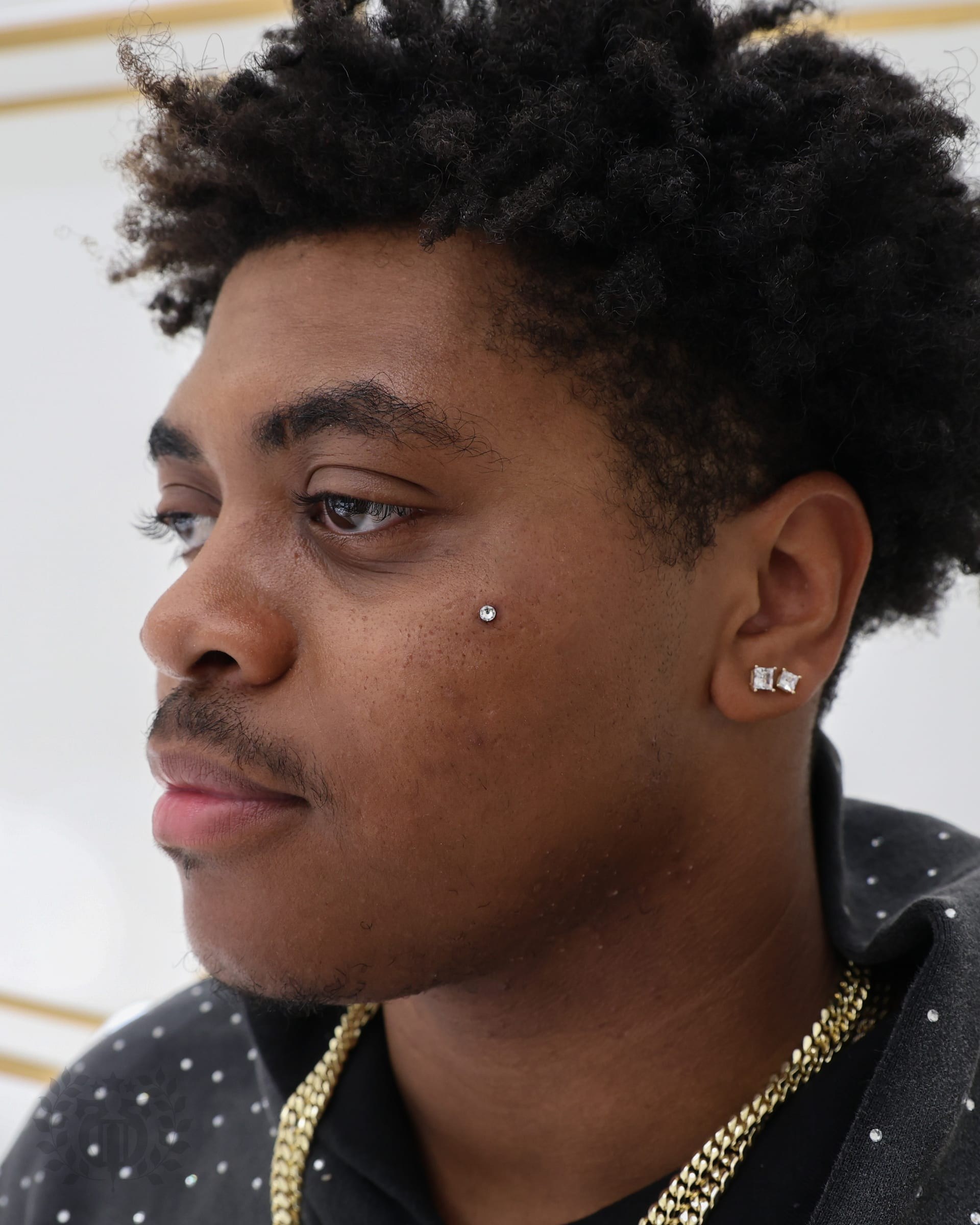 Double facial dermal anchors with cheekbone and eyebrow CZ and lip piercing at Apollo LA