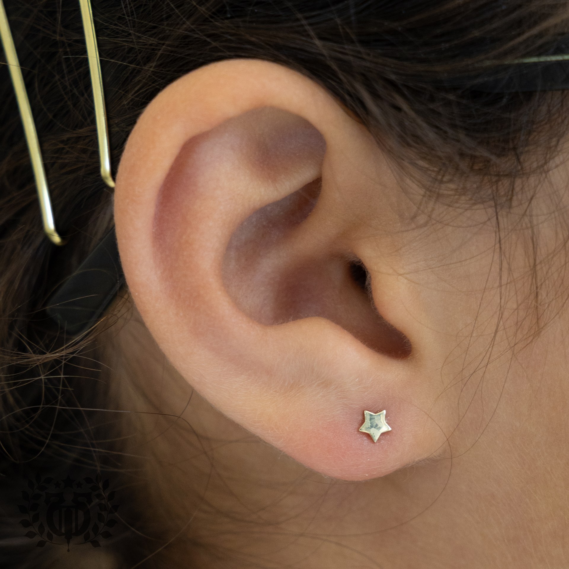 Upper Lobe