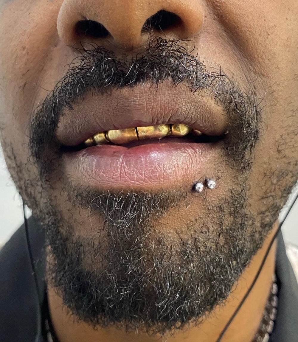 Lip & Oral