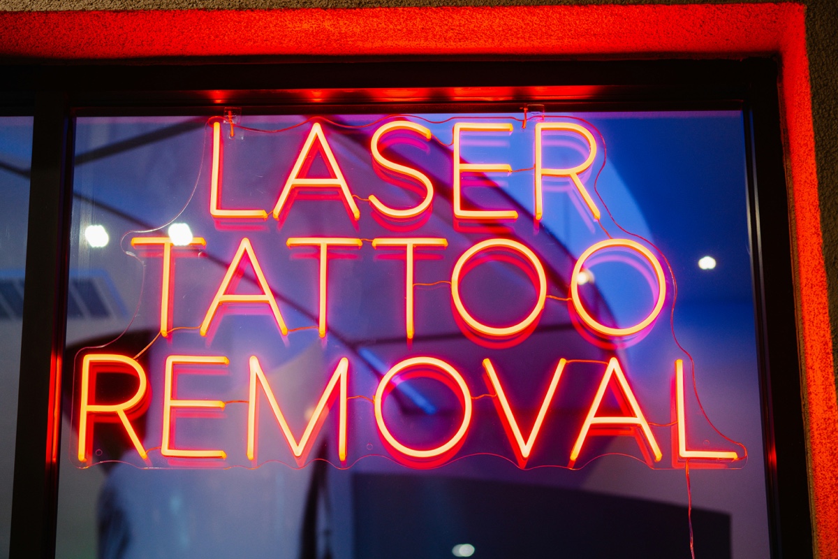 How Much Does Tattoo Removal Cost In 2025? - The Apollo Tattoo &amp; Piercing Studio In Los Angeles — Apollo Studio Los Angeles